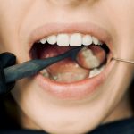 Crucial Information On Getting Treatments To Straighten Misaligned Teeth